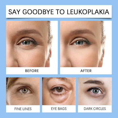 Moisturizing Elastic And Tender Eye Cherry Blossom Collagen Eye Cream