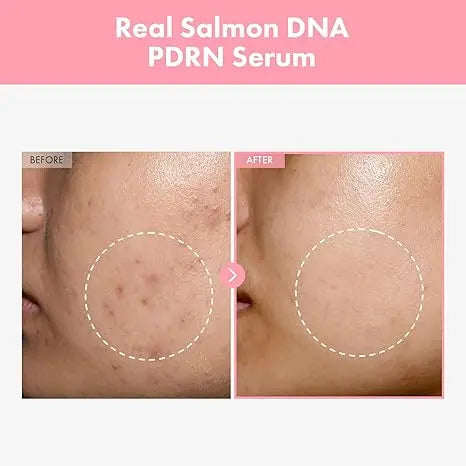 Sérum Visage Liftant Hydratant à la Nicotinamide - BMYANY